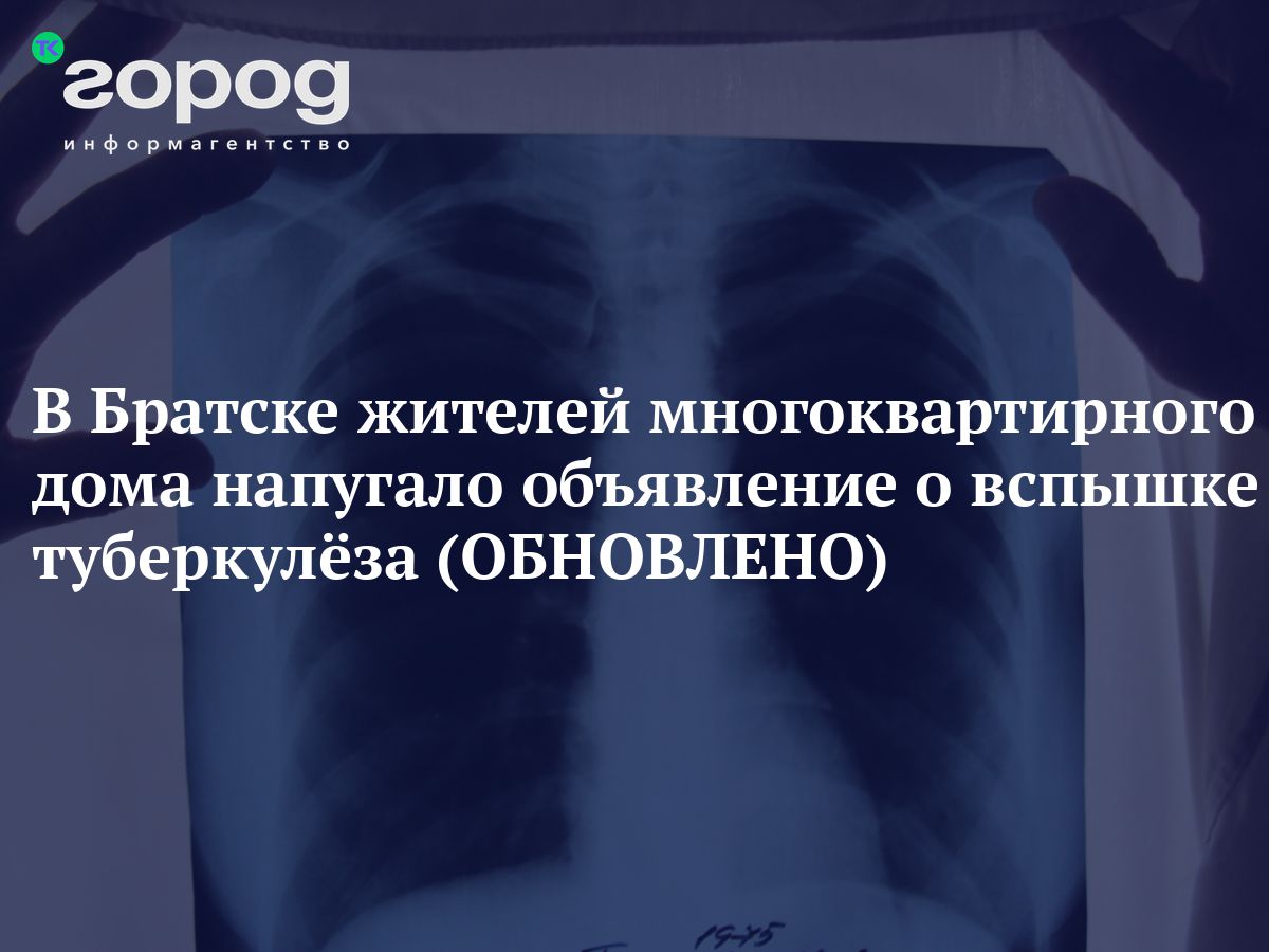 В Братске жителей многоквартирного дома напугало объявление о вспышке  туберкулёза (ОБНОВЛЕНО)